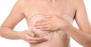 How to Address Concerns About Age and Breast Lift Surgery: Insights from Best Doctors in Dubai